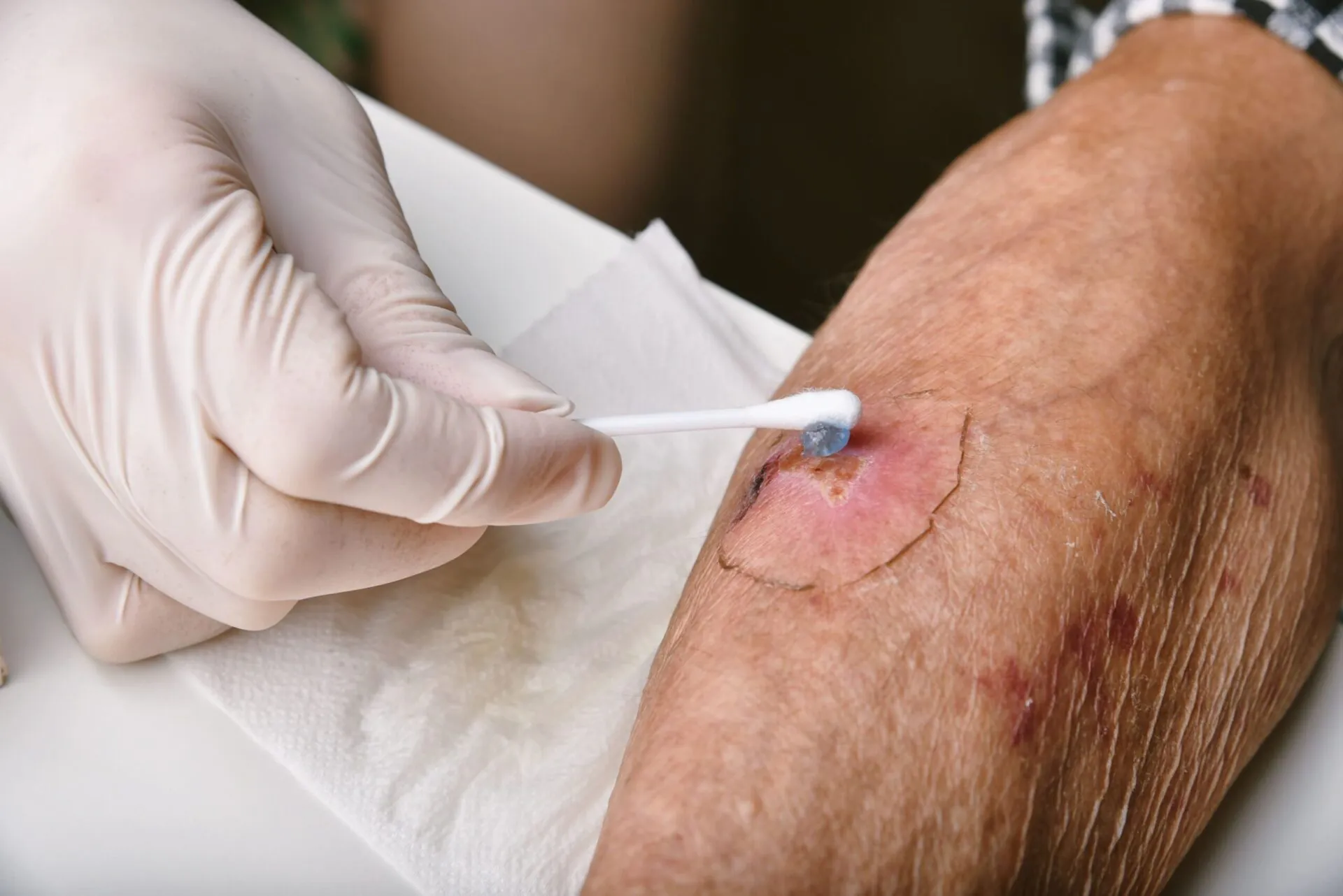 Wound Care